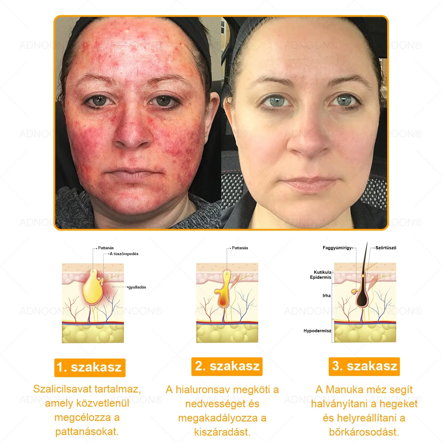 Honey firming cream